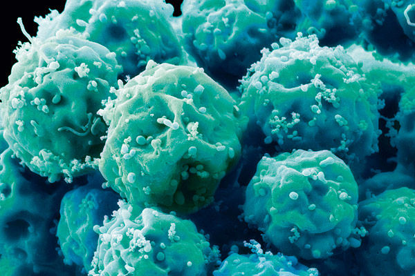 Сибирские ученые научились уничтожать стволовые раковые клетки
