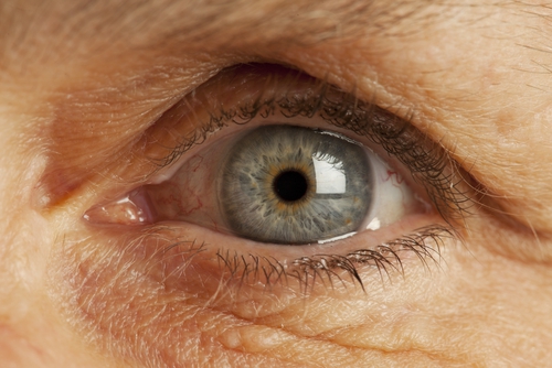 Инсульт и еще 7 заболеваний, которые можно распознать по глазам