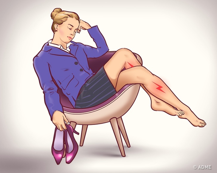 6 неочевидных признаков варикозной болезни ног
