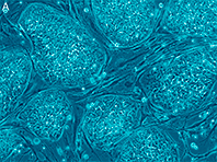 Стволовые клетки больше не в моде, говорят исследователи
